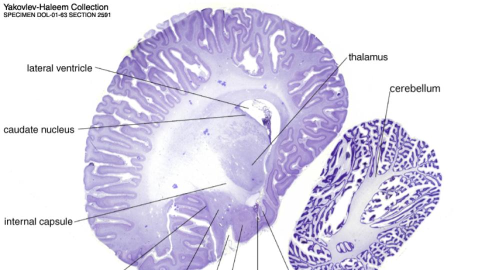 Hawaii Dolphin Watch - The Dolphin Brain